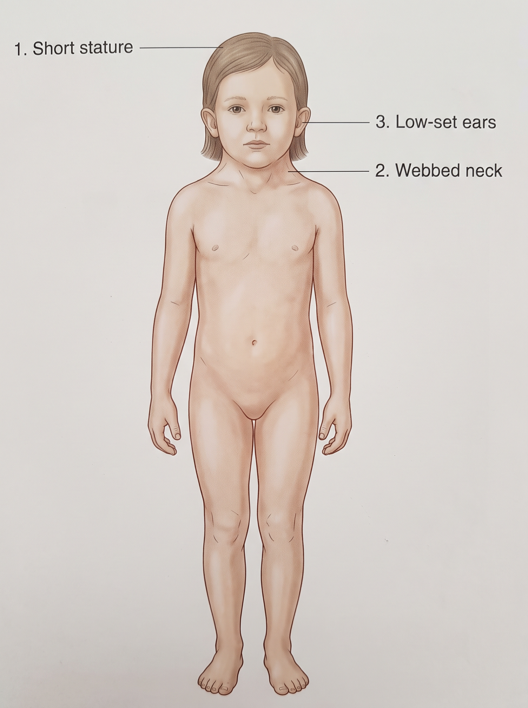 Fig. 8.5