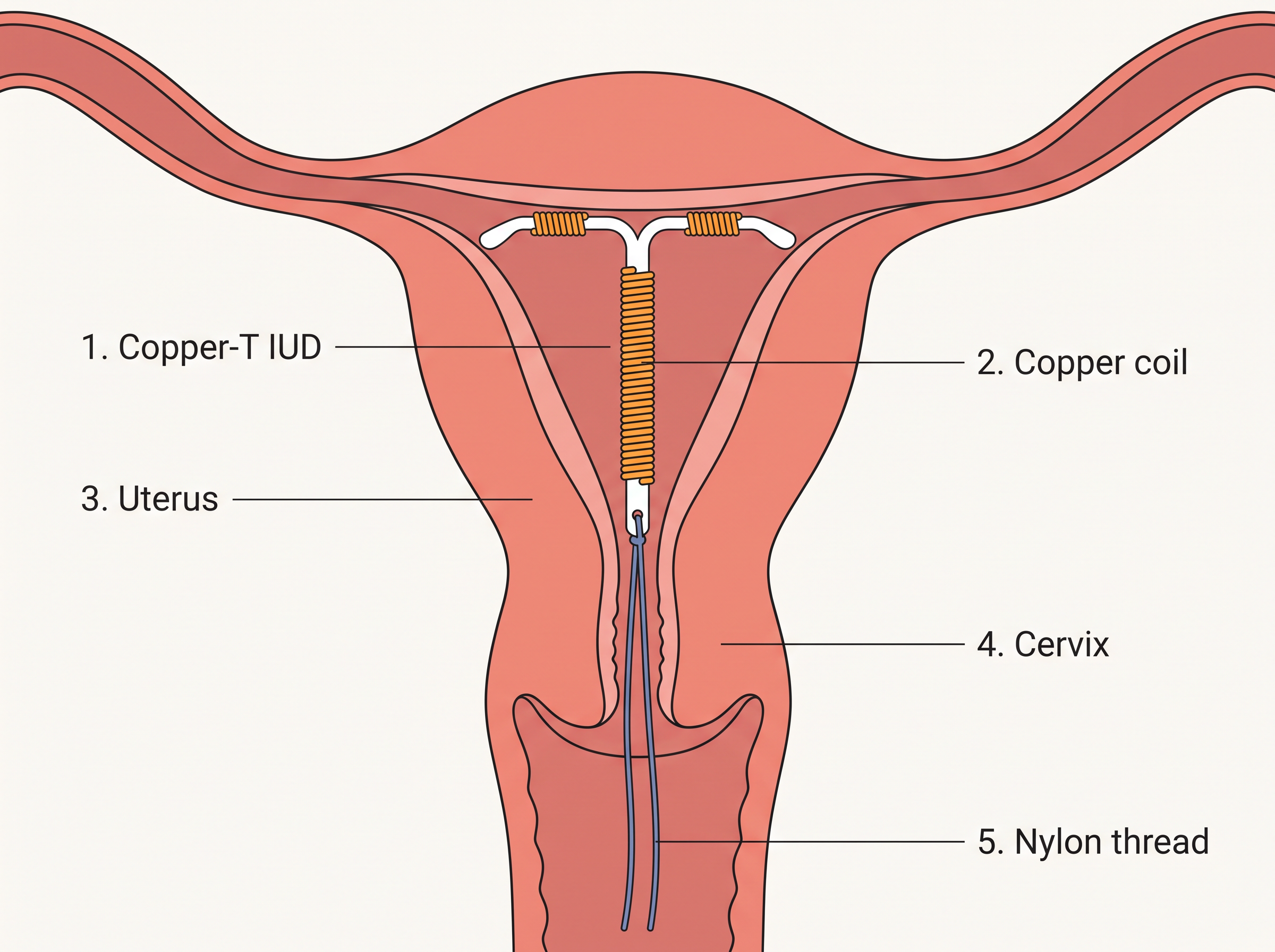 Fig. 3.6