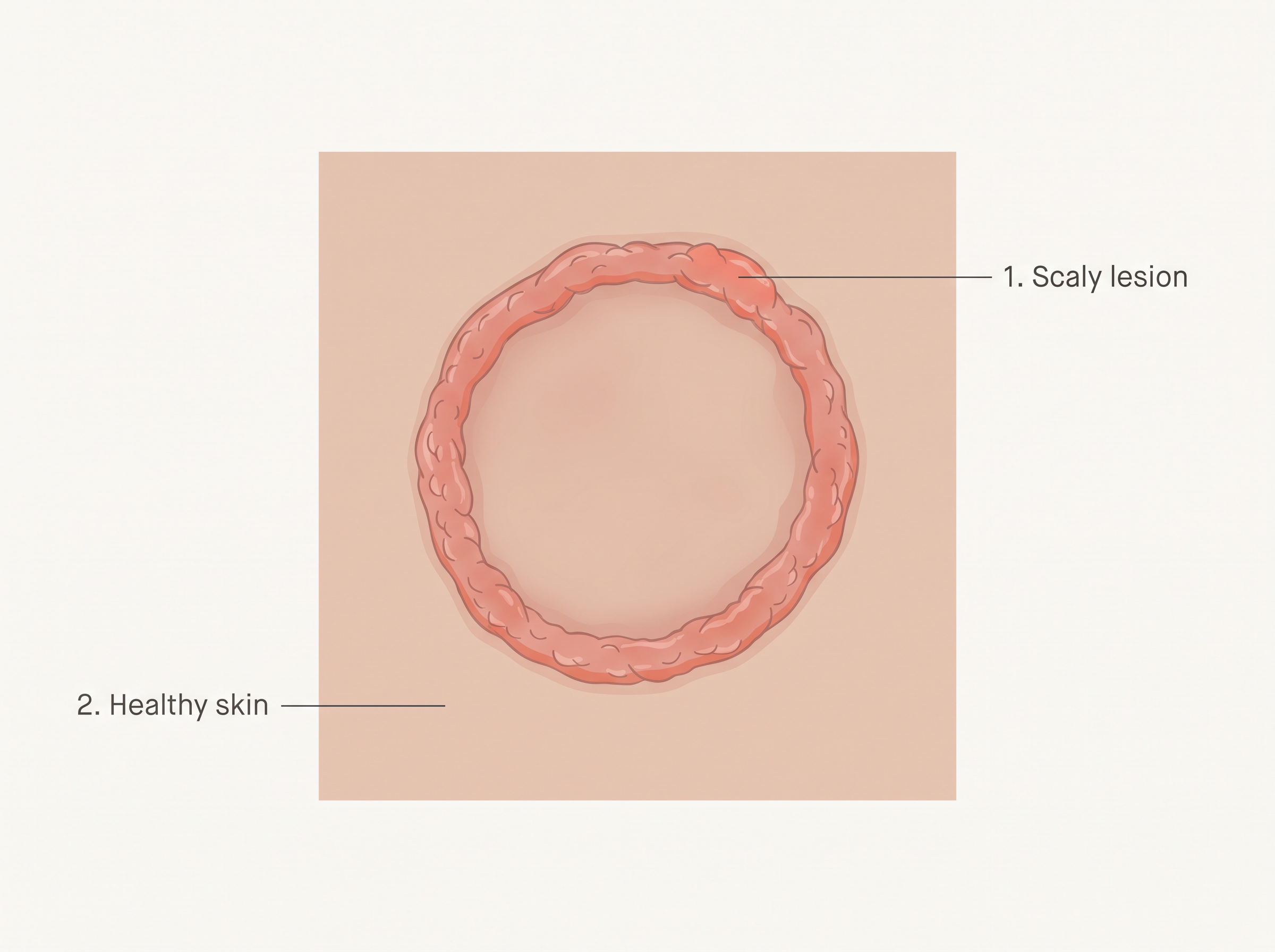 Fig. 7.3
