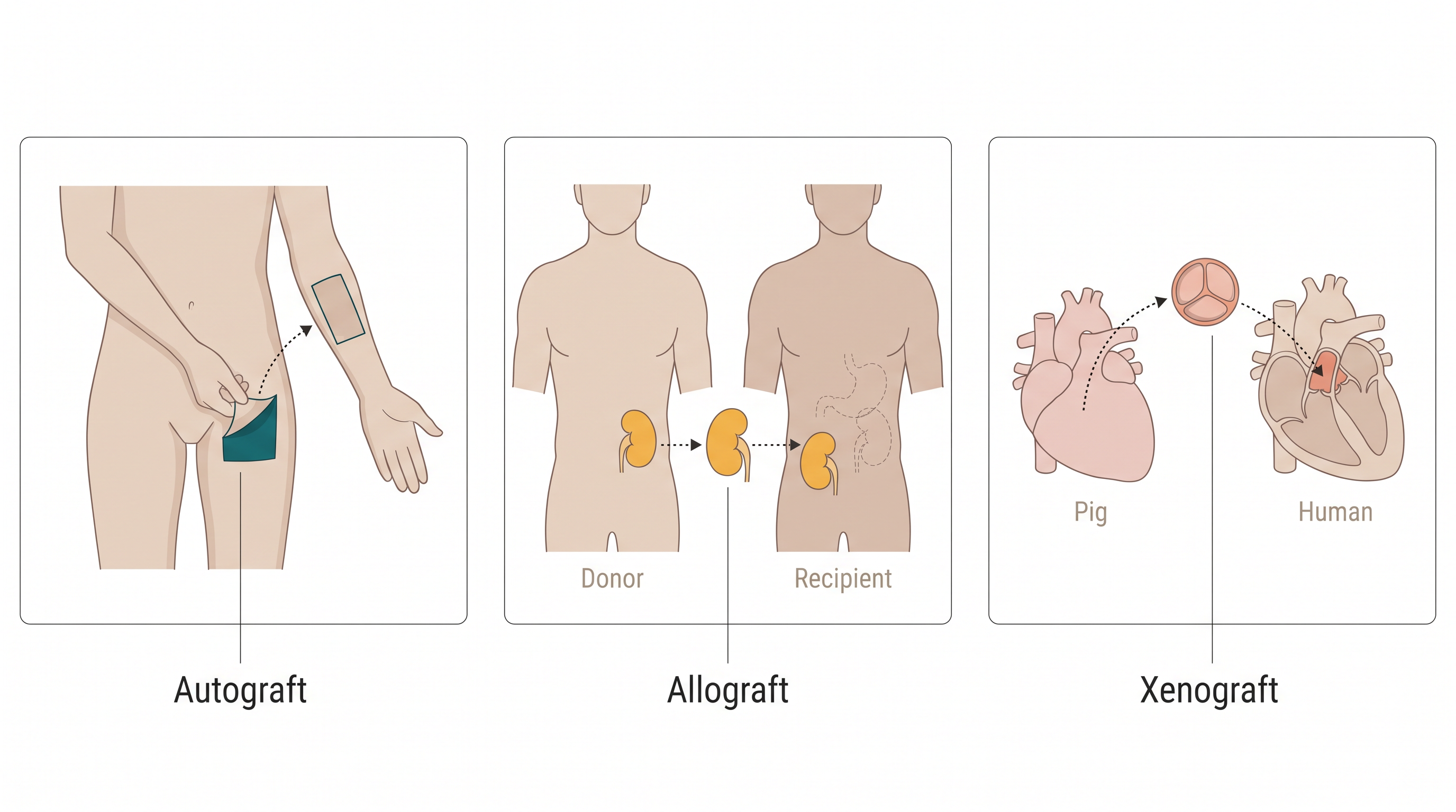 Fig. 12.12
