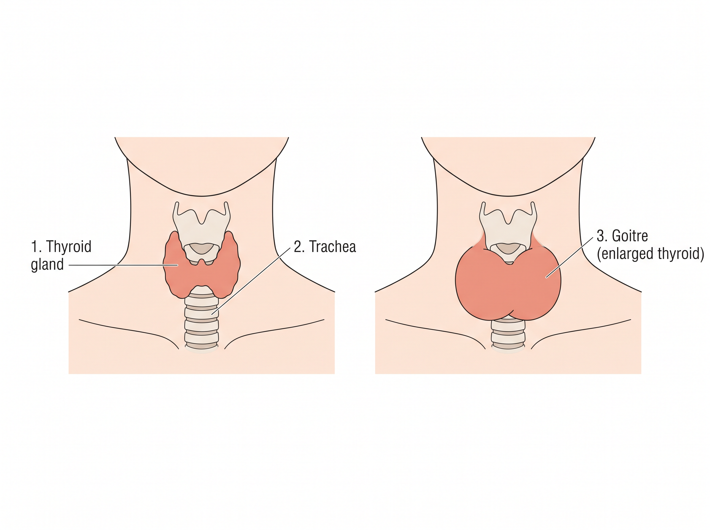 Fig. 3.7